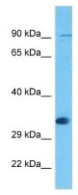 Olfactory receptor 476 Rabbit anti-Mouse, Polyclonal, Novus Biologicals:Antibodies:Primary